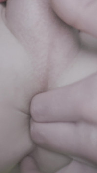 It Hurts, but I Still Need It