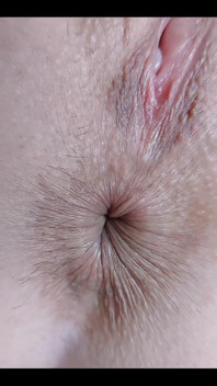 My Little Eye Is Winking at You! Would You Like to Lick It?