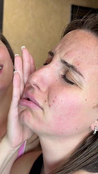 Slap Face - Beating
