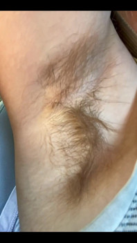 What Do You Think of My Hairy Armpits?
