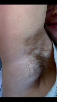 What Do You Think of My Hairy Armpits?