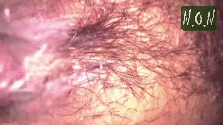 Temptation: Desde el contador de dedos hasta la estrella de pago,...