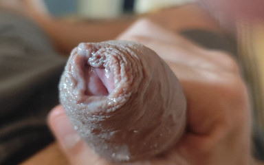 DaddyDoted: Minha Grande Fimose Atrapalha O Orgasmo.