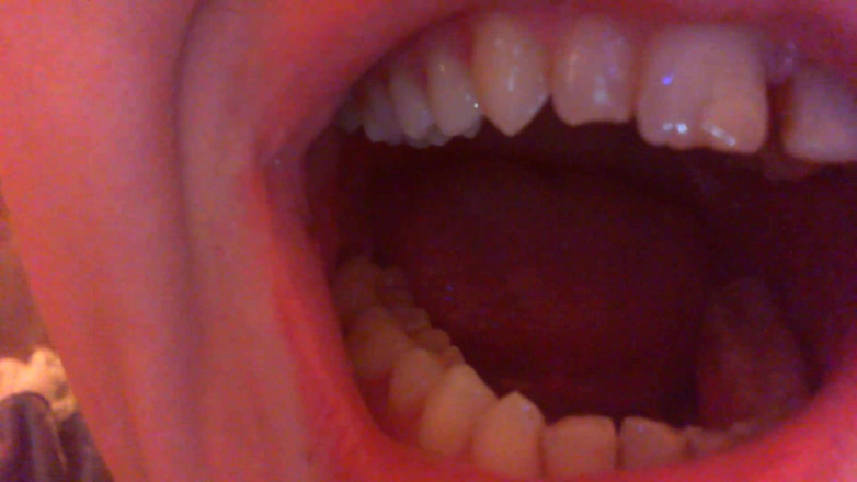 Nicoletta Embassi: Teeth Fetish Devour