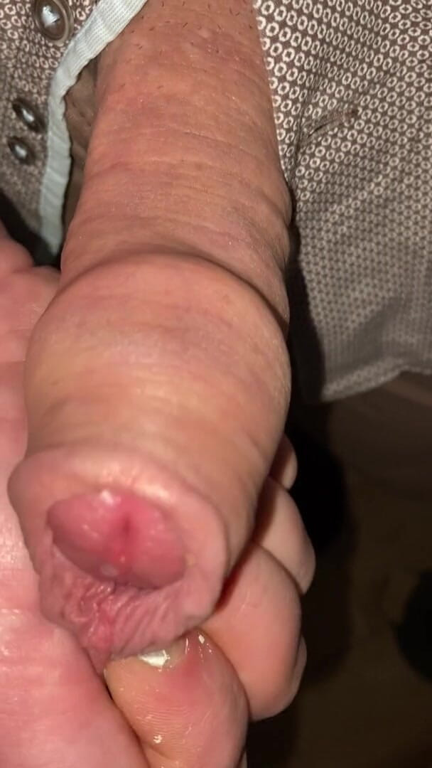 Foreskinguy: 在他自己的包皮中未割包皮射精