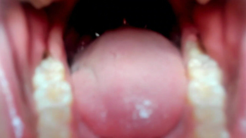 Julie_Bliss: Julie Bliss - Obryně