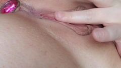 Missi