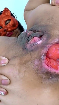 Exl-032: spekulasi besar di pantat dan memek. Prolaps besar dan serviks besar. Adegan ekstrem latina mantan pacarnya-032