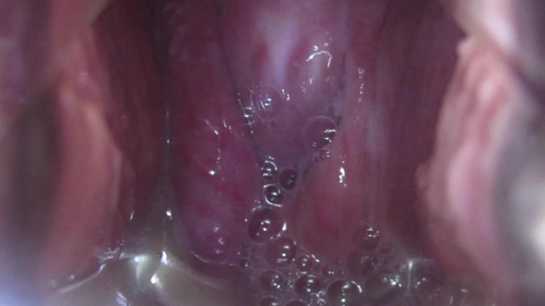 VeeVee Vixen: Cum Cervix Insemination