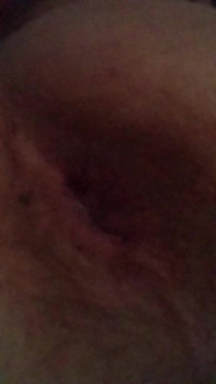 Pulse Ass