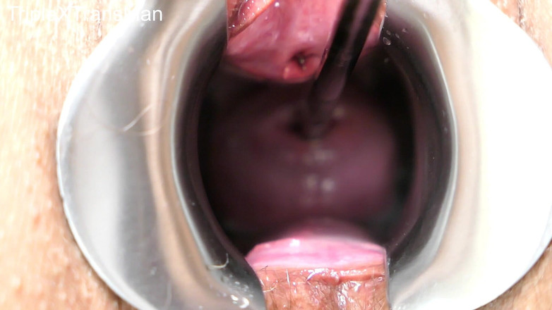 TripleXTransMan: मेरी गर्भाशय ग्रीवा में घुसना!