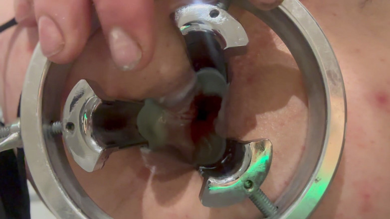 No limit cbt slave: Mencurahkan lilin lilin panas ke dalam keldai