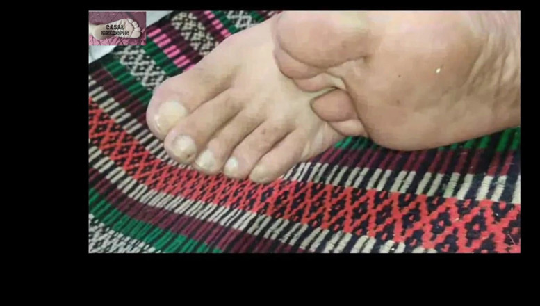 Casal Gresopio Male: Cock and Feet 7