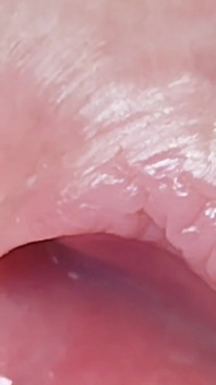 Extreme Dirty Daddy's Widened Hole.