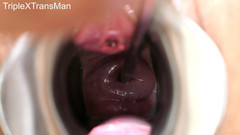 TripleXTransMan: Penetrace mého děložního čípku!
