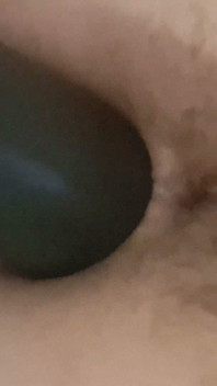 Dilatation