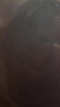 Extrémní pumpování penisu