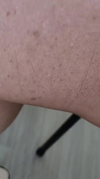 Arqueamento em meia-calça.
