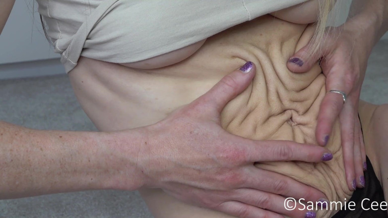 Sammie Cee: My wrinkly tummy