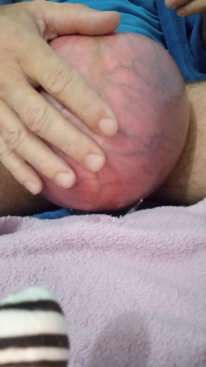 Lion big balls: Không khí cực đoan