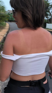 She Really Likes to Sunburn