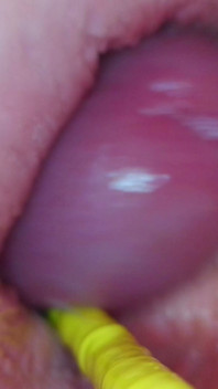 Extreme POV Inside the Action Fuck All Holes My Stepsis with Endoscopy Jessijek