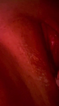 Vibrator