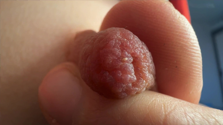 Skinny_lady69: Bradavky Super zblízka