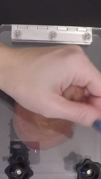 Limpando os resultados da uretra em fluxo abundante de esperma