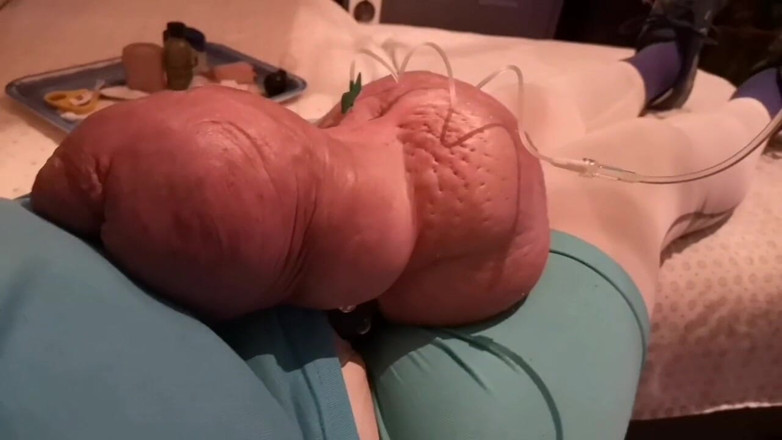 Monster_Meat_: Napełnianie glukozy 10%