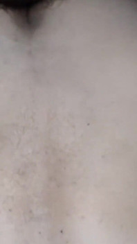 Destroying the Asshole on the Dick