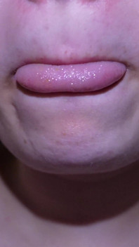 Asmr Eating Video