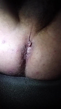 फिस्टिंग