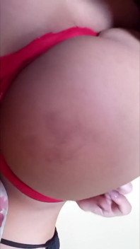 My Butt Cheek Got Purple From a Spanking