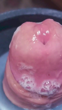 Penis Machine with a New Attachment