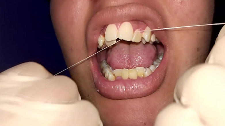Elimoon: Pokus o používání zubní nitě (detailní záběr)