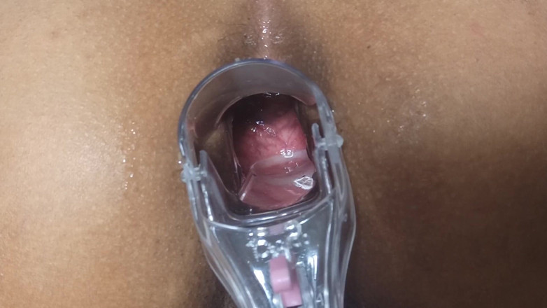 Xamy_97: spekulum i min anus del 2