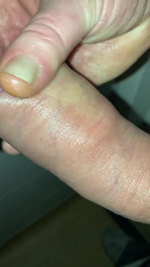 Foreskinguy: Uzun, pompalanmış şişkin sünneti yarak ve boşalma