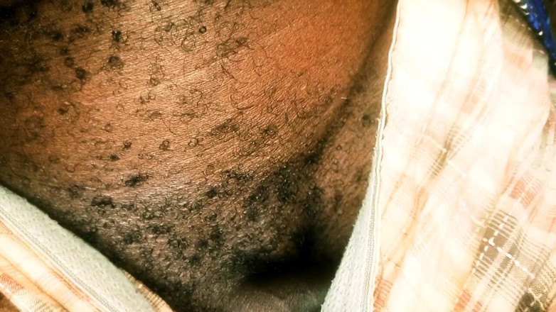 Judith xxx: 마사지 109화