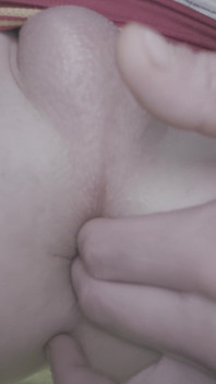 It Hurts, but I Still Need It