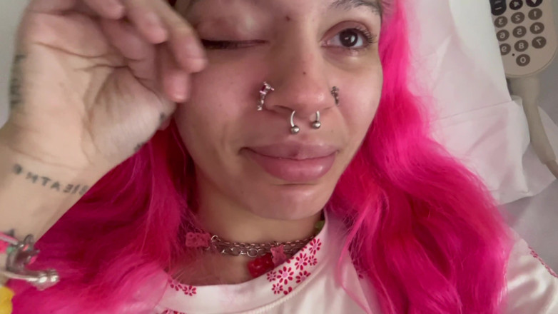 Nali Marie: Scar Fetishes Stitches Staples Hospital Recovery After Surgery Teen Petite...