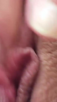 Marie must go to the gynecologist