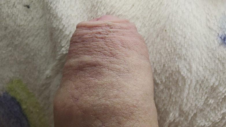 Nalekhome: 我的鸡巴在宏观上