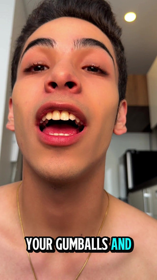 aodaboy: 在外面戴上牙套，我们需要庆祝