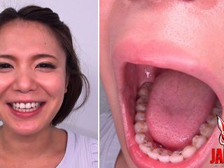 Japan Fetish Fusion: Examinarea dinților - Frumusețe fără editare