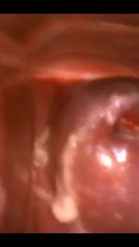 Who Want See What Is Inside Me?? Inside My Pussy??:) Look This Video