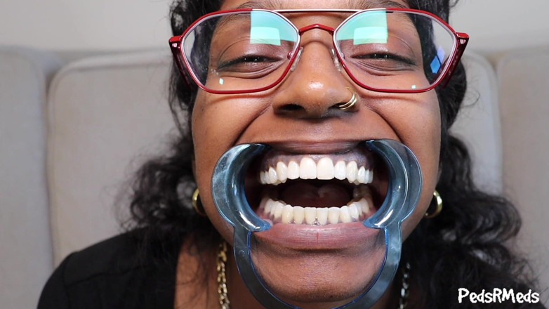 PedsRMeds: Youronlyphoenix Dental Retractor gura tur