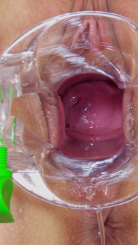 Examen cervical de la joven rubia gordita Cayla Lyons por 2 médicos