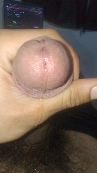 Smegma Big Uncut Smell