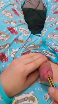 Sondând pentru prima dată cu un creion - Abdl